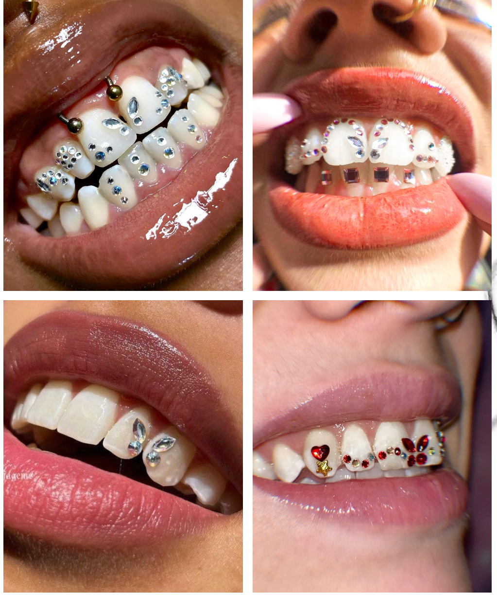 π Pro Tooth Gem Starter Kit β Complete Set for Aspiring Technicians & Certified Artists