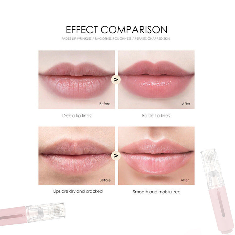 ๐ 3-in-1 Lip Boosting Roller โ DIY Plumping + Hydration Tool