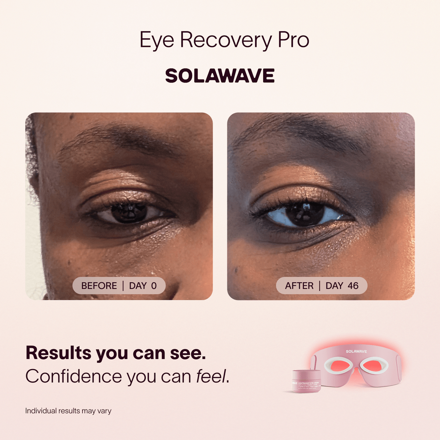 Solawave Eye Recovery Pro Kit