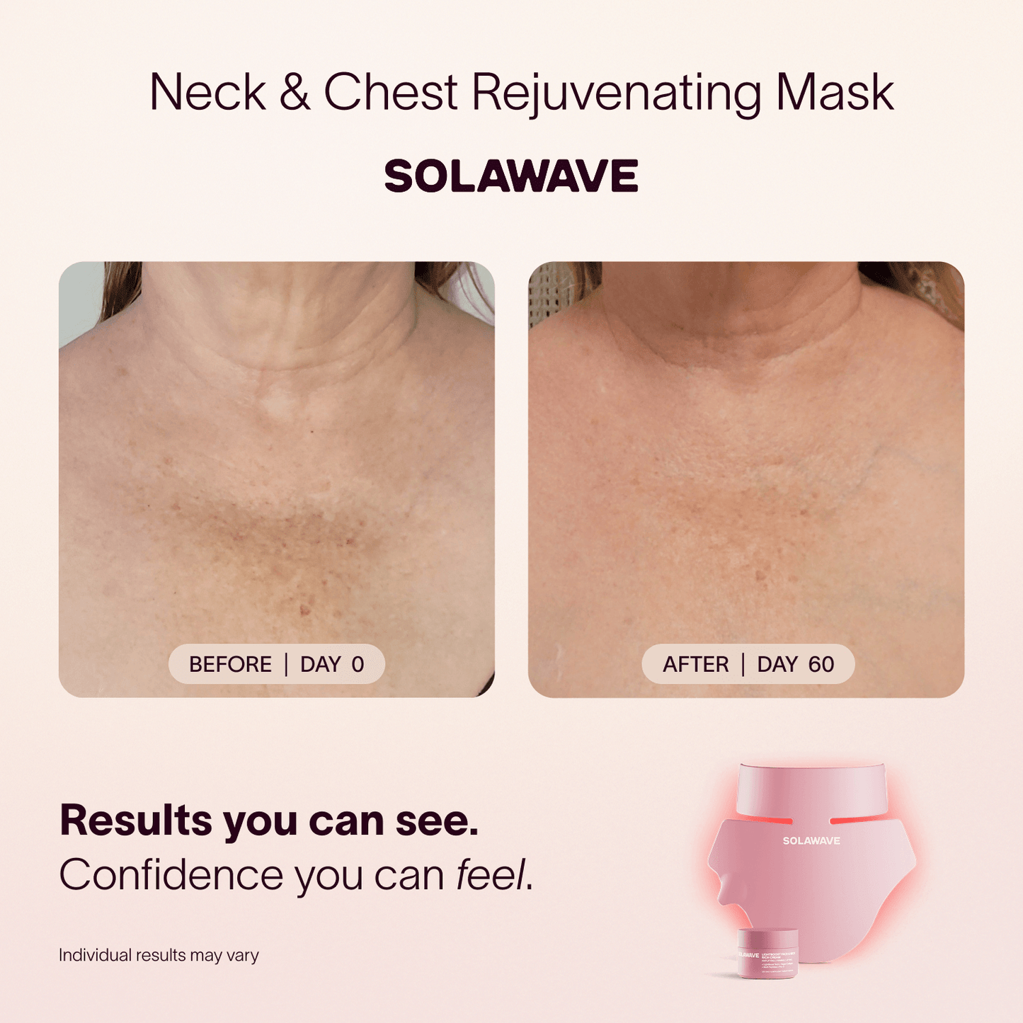 Solawave Neck & Chest LED Mask w/ LightBoost Cream Kit