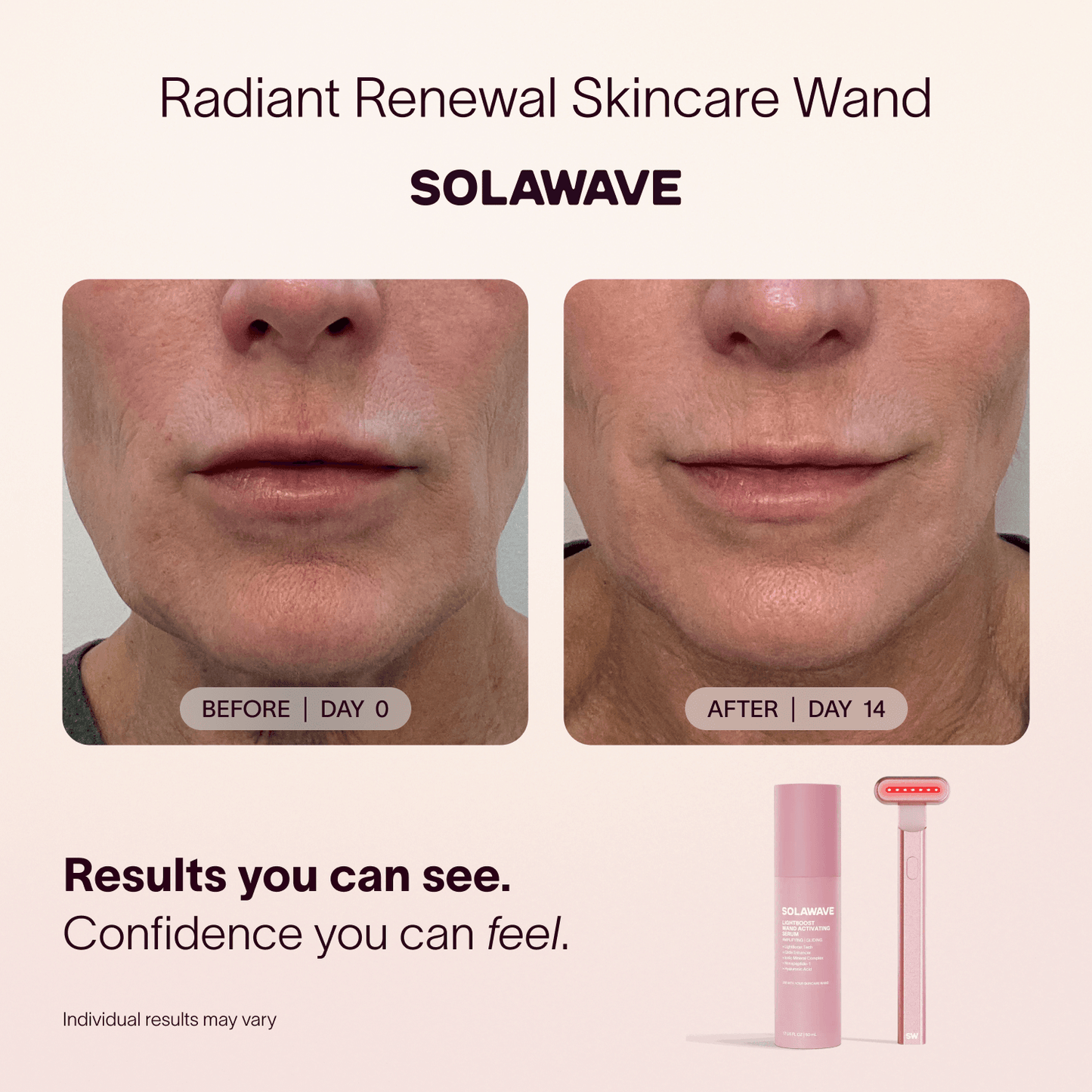 Solawave 4-in-1 Red Light Therapy Wand & Activating Serum Kit