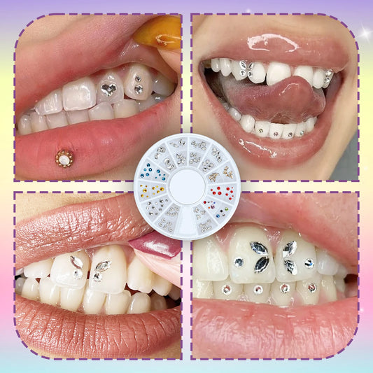 ✨ DIY Temporary Tooth Gem Kit – 1–2 Day Glam Smile Kit (Non-Permanent)